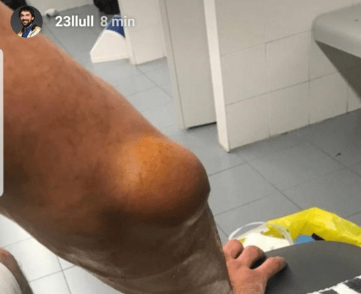 Codo Llull lesión Alba Berlín